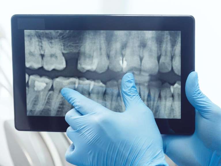 childrens dentist miami | x-rays