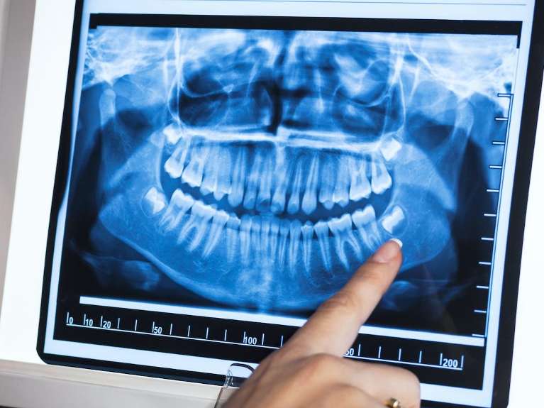 childrens dentist miami | panoramic x-rays